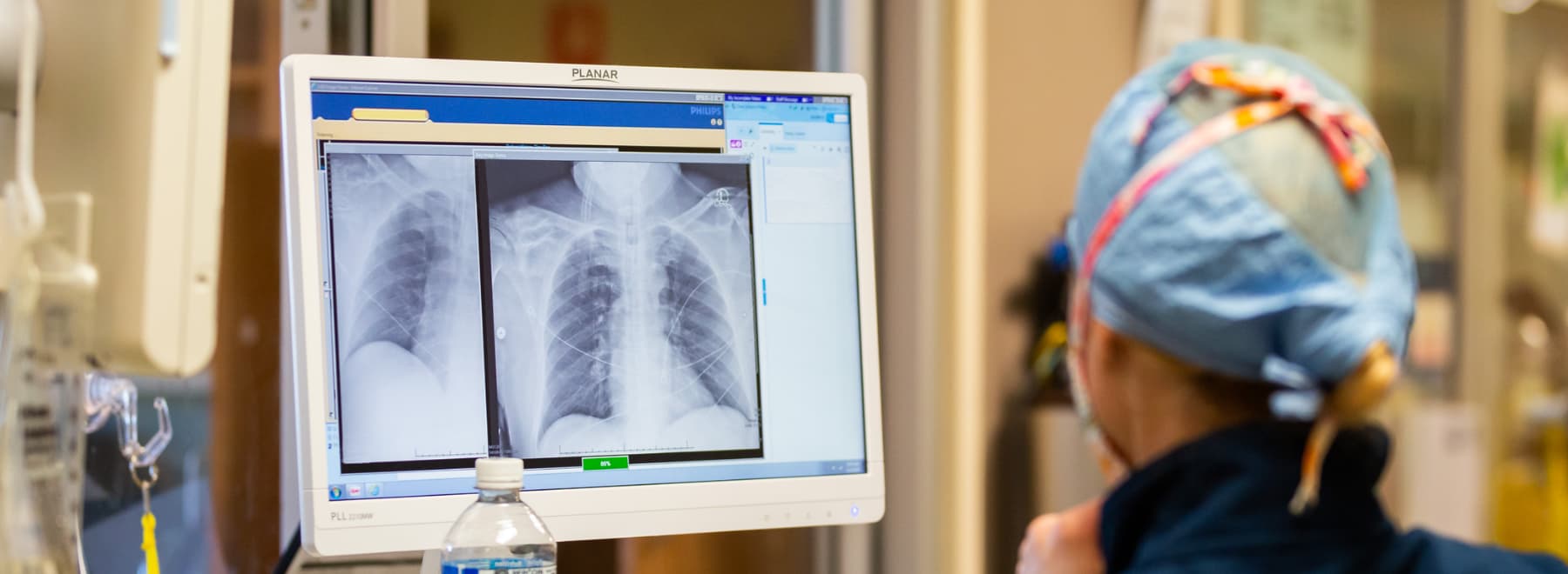 A pulmonologist reviews chest imaging.